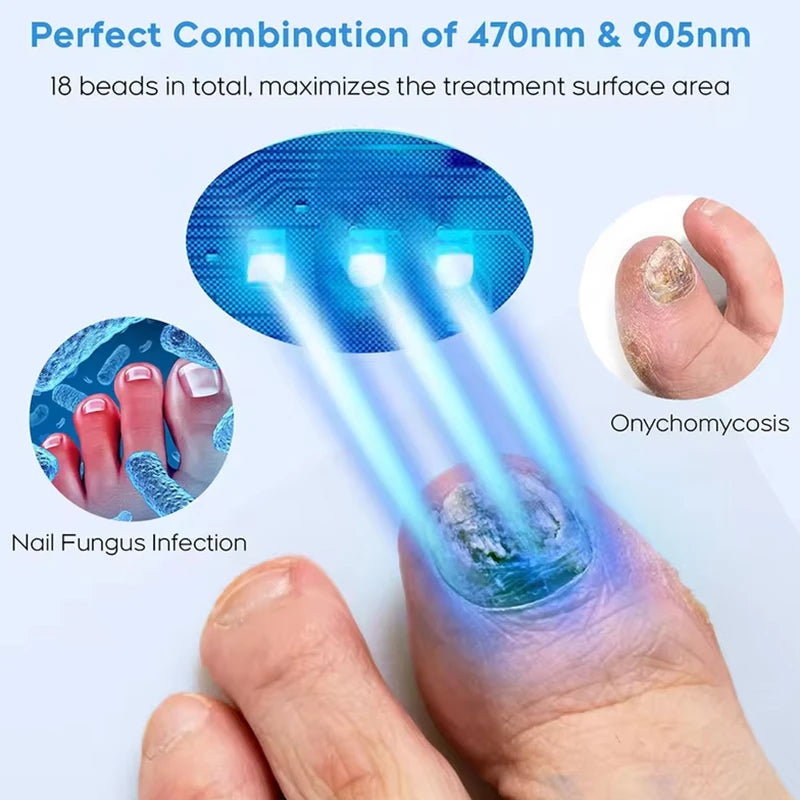 KTS Fungal Nail Laser Device Repair Fast Nails Fungus Onychomycosis Repair Toenail Fingernail Removes Nail Fungus Foot Care